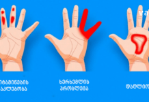 ხელების დაბუჟების 4 მიზეზი – ამის ცოდნა აუცილებელია