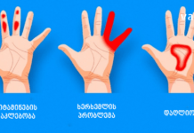 ხელების დაბუჟების 4 მიზეზი – ამის ცოდნა აუცილებელია