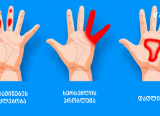 ხელების დაბუჟების 4 მიზეზი – ამის ცოდნა აუცილებელია