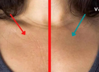 თქვენს წინაშეა გამოცდილი რეცეპტები ყელისა და დეკოლტეს მიდამოში ნაოჭების მოსაშორებლად!