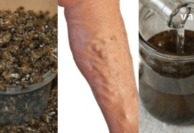 ნაყენი ბებიას სამზარეულოდან ჯანსაღი ვენებისთვის და სისხლის უკეთესი მიმოქცევისთვის!