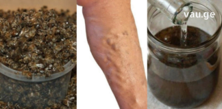 ნაყენი ბებიას სამზარეულოდან ჯანსაღი ვენებისთვის და სისხლის უკეთესი მიმოქცევისთვის!