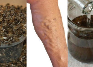 ნაყენი ბებიას სამზარეულოდან ჯანსაღი ვენებისთვის და სისხლის უკეთესი მიმოქცევისთვის!