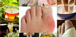 ჩემს მამამთილს წლების განმავლობაში აწუხებდა ნიკრისის ქარი, გაწამდა და დაიტანჯა. ბოლოს ხალხური რეცეპტი სცადა და შესანიშნავი შედეგი მიიღო.