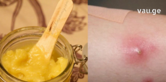 ამის შემდეგ სამუდამოდ განიკურნებით ძირმაგარასგან – დროში გამოცდილი რეცეპტები !