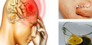 ქრონიკული თავის ტკივილის განკურნება სახლში მომზადებული ნაყენით – დაუჯერებელია, თუმცა სავსებით რეალური!