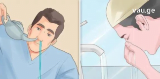 7 ხრიკი, რომელსაც შეუძლია შეამსუბუქოს ჰაიმორიტის სიმპტომები და შეიძლოა მთლიანადაც გაქრეს.