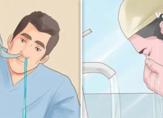 7 ხრიკი, რომელსაც შეუძლია შეამსუბუქოს ჰაიმორიტის სიმპტომები და შეიძლოა მთლიანადაც გაქრეს.