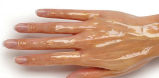 დამსკდარი ხელები ერთ-ერთი ყველაზე დიდი პრობლემაა, აი როგორ უნდა მოვუაროთ მარტივად.