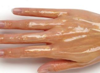 დამსკდარი ხელები ერთ-ერთი ყველაზე დიდი პრობლემაა, აი როგორ უნდა მოვუაროთ მარტივად.