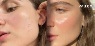 მე ვზრუნავ სახის კანზე: მარტივად ვასუფთავებ კანს აკნესგან და ვავიწროვებ ფორებს !