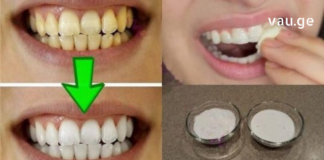 ქოქოსის ზეთი: ბევრად ეფექტური და ჯანსაღი ვიდრე ნებიამიერი კბილის პასტა