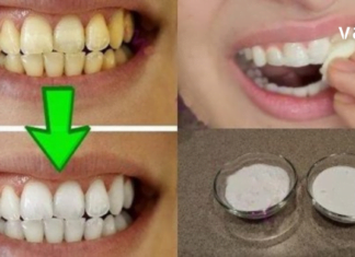 ქოქოსის ზეთი: ბევრად ეფექტური და ჯანსაღი ვიდრე ნებიამიერი კბილის პასტა