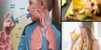 ებრძოლეთ ასთმას ლიმონის წვენით – წარმოუდგენელი დამხმარე საშუალება!