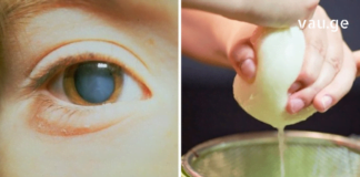 კატარაქტას მკურნალობა არც თუ ისე რთულია როგორც თქვენ წარმოგიდგენიათ – მცენარეული რეცეპტებით უმოკლეს დროში გადაჭრით ამ პრობლემას.