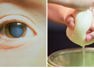 კატარაქტას მკურნალობა არც თუ ისე რთულია როგორც თქვენ წარმოგიდგენიათ – მცენარეული რეცეპტებით უმოკლეს დროში გადაჭრით ამ პრობლემას.