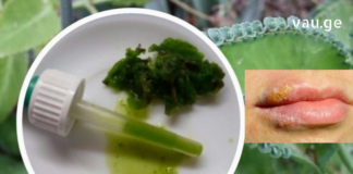 მომხმარებლის ნაამბობი, როგორ მოიცილა ჰერპესი სახლის პირობებში