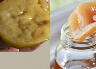 მოიცილეთ გლანდების ანთება სულ რაღაც 24 საათში : დროში გამოცდილი ყველაზე ეფექტური მეთოდი!