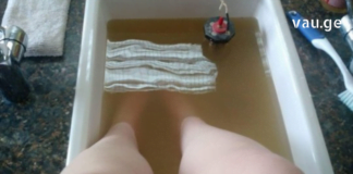 ნახეთ რა მარტივია ჩაზრდილი ფრჩხილის მკურნალობა ქირურგიული ჩარევების გარეშე