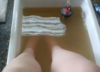 ნახეთ რა მარტივია ჩაზრდილი ფრჩხილის მკურნალობა ქირურგიული ჩარევების გარეშე