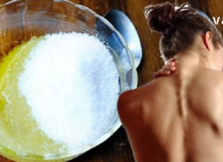 კისერზე მარილები დაგიგროვდათ? ეს კარტოფილის კომპრესი ტკივილს სამუდამოდ დაგავიწყებთ!