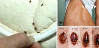 შეამოწმეთ საწოლი! ტკიპები ხომ არ არიან?! რისი ეშინიათ და როგორ მოვიშოროთ ?!