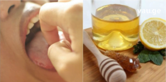 თუ ამ ნაყენს გამოივლებთ პირის ღრუში, უსიამოვნო სუნი გაქრება!
