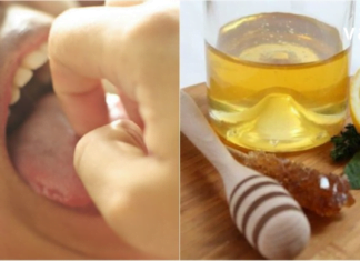 თუ ამ ნაყენს გამოივლებთ პირის ღრუში, უსიამოვნო სუნი გაქრება!