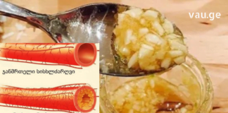 ეფექტური Ხალხური საშუალებები ათეროსკლეროზის სამკურნალოდ