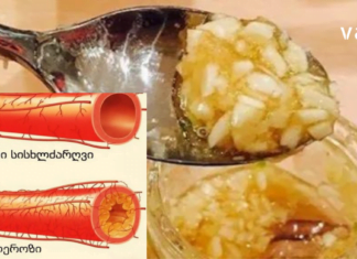 ეფექტური Ხალხური საშუალებები ათეროსკლეროზის სამკურნალოდ