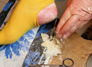 როგორ უნდა დაარბილოთ დამსკდარი ქუსლები ბუნებრივად ამ საშუალებებით..შეხვდით ზაფხულს მომზადებული.