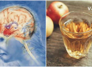 წლების განმავლობაში ვიტანჯებოდი შაკიკით, თურმე საუკეთესო მკურნალი სახლში მქონია და არ ვიცოდი!