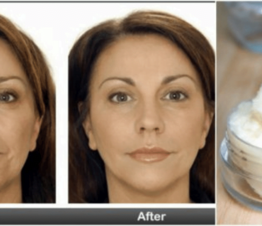 სახის მოვლა არასოდეს ყოფილა ასეთი მარტივი : სახლში მომზადებული ამ კრემის ეფექტი ყველამ უნდა შეიგრძნოს..