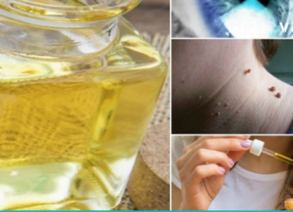 უნივერსალური და შეუცვლელი აბუსალათინის ზეთი, რომელიც ბევრი პრობლების საუკეთესო მშველელია…