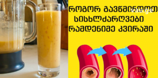 ჯადოსნური ნაყენის წყალობით გავიწმინდე სისხლძარღვები: ყველამ უნდა იცოდეთ ამ რეცეპტის შესახებ