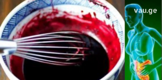 ნაღვლის ბუშტის მკურნალობის ახალი მეთოდი აღმოვაჩინე, რომელიც მინდა თქვენც გაგიზიაროთ!