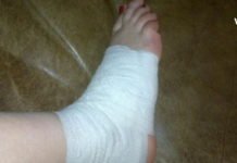 თუ არ იცით რა მოიმოქმედოთ ნაღრძობის, დაჟეჟილობისა და მოტეხილობის მოსარჩენად, გაგიზიარებთ ეფექტურ რეცეპტს.