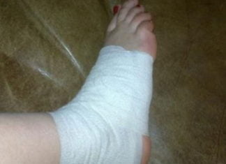 თუ არ იცით რა მოიმოქმედოთ ნაღრძობის, დაჟეჟილობისა და მოტეხილობის მოსარჩენად, გაგიზიარებთ ეფექტურ რეცეპტს.