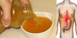 შეაჩერეთ გულძმარვა სულ რაღაც 1 წუთში! სწრაფად მოქმედი მეთოდი!