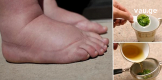 თუ ფეხები გიშუპდებათ, პრობლემის მოგვარებას სახლში ნატურალური რეცეპტების დახმარებით შეძლებთ.