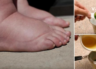 თუ ფეხები გიშუპდებათ, პრობლემის მოგვარებას სახლში ნატურალური რეცეპტების დახმარებით შეძლებთ.