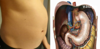 მუცლის შებერილობა– პრობლემა, რომელიც ადამიანების უმრავლესობას აწუხებს. მაგრამ მისი მოგვარება შესაძლებელია და ჩვენ ამაში დაგეხმარებით.