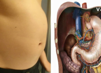 მუცლის შებერილობა– პრობლემა, რომელიც ადამიანების უმრავლესობას აწუხებს. მაგრამ მისი მოგვარება შესაძლებელია და ჩვენ ამაში დაგეხმარებით.