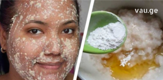 ასაკობრივი ლაქების ნებისმიერი პრობლემის მოხსნა შეუძლია ამ მეთოდს: დაგჭირდებათ: 30 გრ ხურმის ფოთოლი; 30 გრ ვაზელინი.