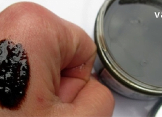 რომ არა ეს სასწაული წამალი ვერასდროს მოვირჩენდი ფსორიაზს..