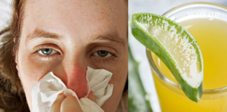 თუ სურდოს დროს ცხვირზე კანი გიღიზიანდებათ სცადეთ ეს მეთოდები