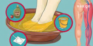 5 წლის წინ დაეწყო დედაჩემს საჯდომი ნერვის ანთება. ისე სტკიოდა, ადგილს ვერ პოულობდა – რამდენიმე ეფექტური ხალხური საშუალება აღმოვაჩინე და ამოისუნთქა კიდეც.