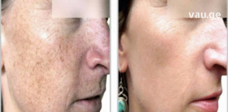 არ გაქვთ საკმარისი დრო კანის ინტენსიური მოვლისთვის? გაგიზიარებთ რამდენიმე რჩევას კანის სწრაფი გაჯანსაღებისთვის..