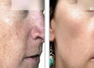 არ გაქვთ საკმარისი დრო კანის ინტენსიური მოვლისთვის? გაგიზიარებთ რამდენიმე რჩევას კანის სწრაფი გაჯანსაღებისთვის..