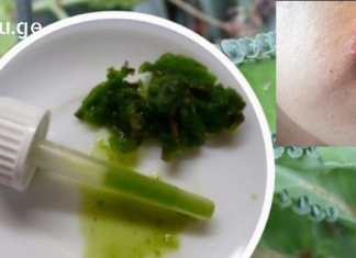 დღეიდან თქვენ არ ინერვიულებთ გარეგნული იერის გამო, როცა ჰერპესის ინფექცია მწვავდება: ამ სტატიაში შეიტყობთ, როგორ უმკურნალოთ ჰერპესს სახლის პირობებში.